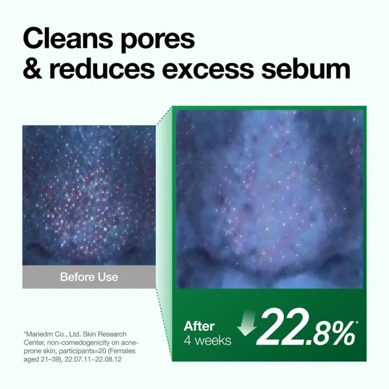 Anua Heartleaf Pore Control Cleansing Oil 200ml – Λάδι Καθαρισμού & Ντεμακιγιάζ Προσώπου για Πόρους, Μαύρα Στίγματα & Λιπαρότητα