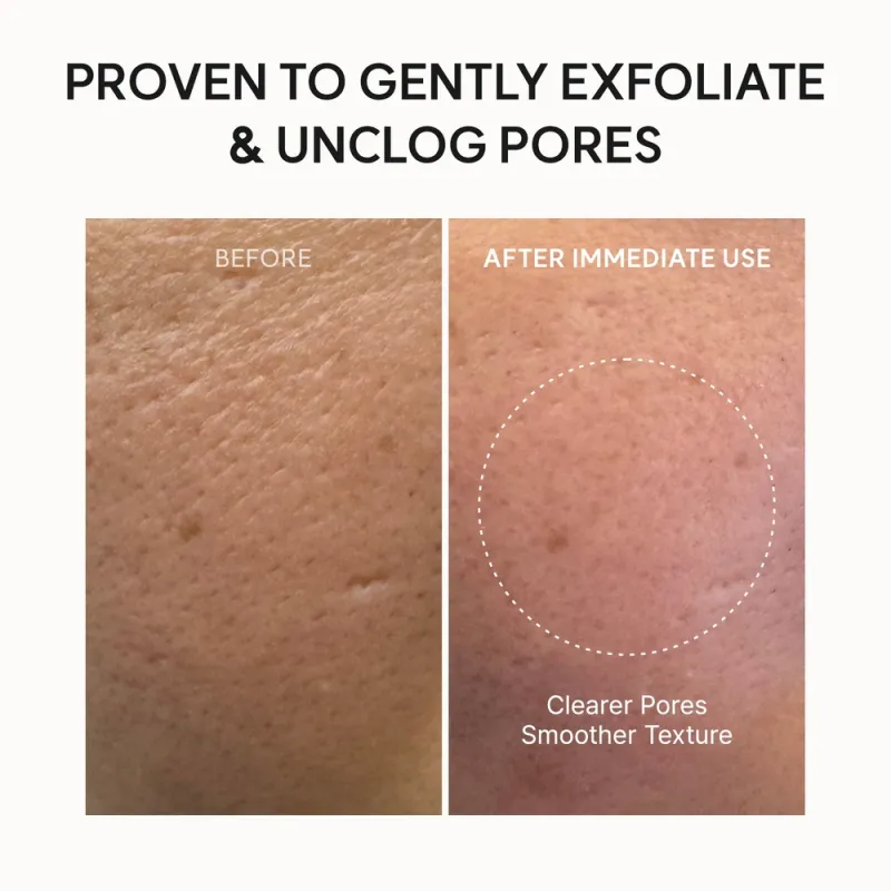 Arencia Fresh Green Rice Mochi Cleanser 120g – Καθαριστικό Προσώπου με Ρύζι για Λιπαρή, Ακνεϊκή & Συμφορημένη Επιδερμίδα Arencia Fresh Green Rice Mochi Cleanser 120g – Καθαριστικό Προσώπου με Ρύζι για Λιπαρή, Ακνεϊκή & Συμφορημένη Επιδερμίδα