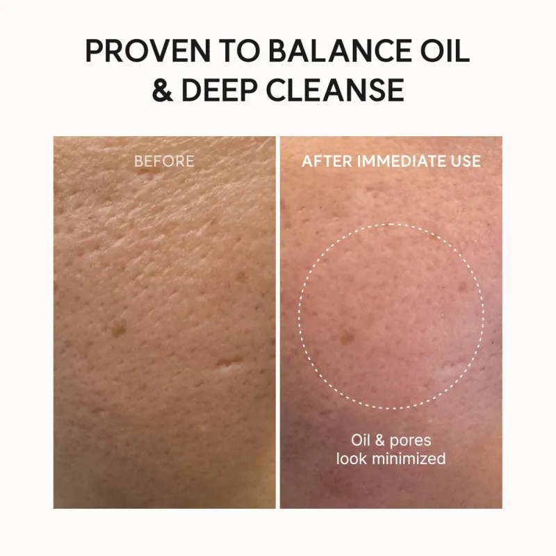 Arencia Blue Hyssop Rice Mochi Cleanser 120g – Καθαριστικό Προσώπου με Ρύζι για Λιπαρή, Ακνεϊκή & Συμφορημένη Επιδερμίδα